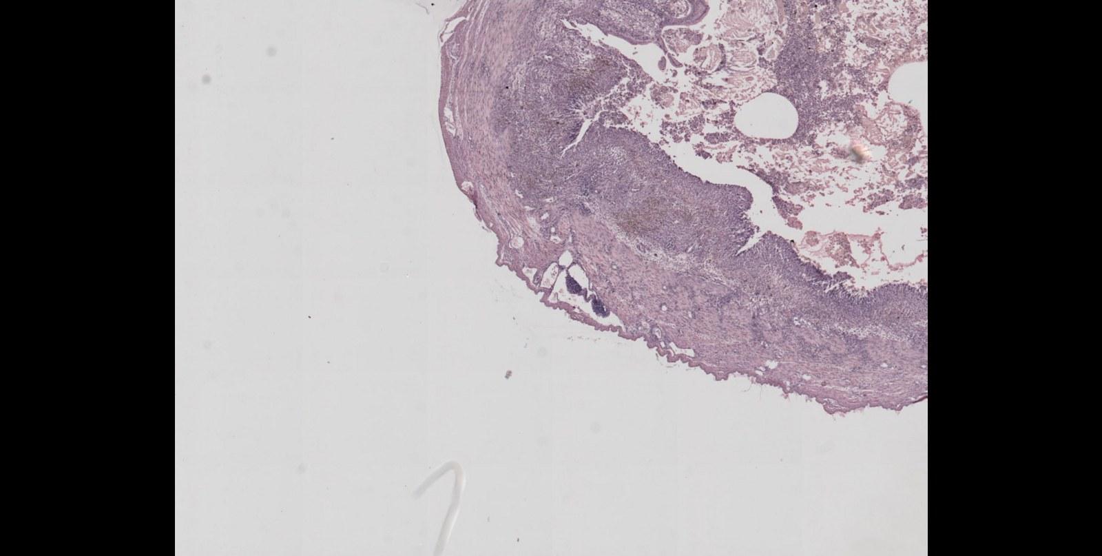 Panoramablick über Eime – Rathaus, Maschsee und Skyline